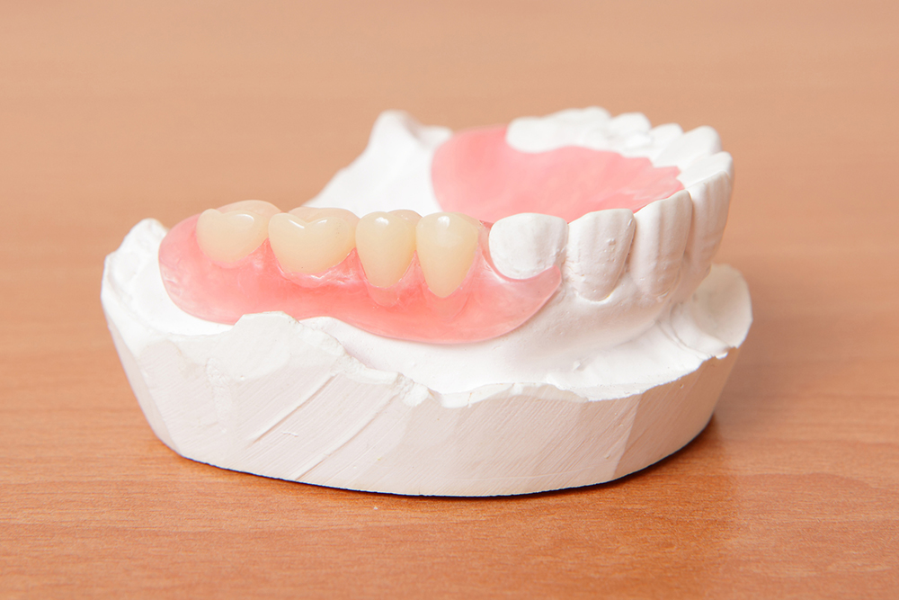 多くの入れ歯素材からより良い入れ歯を選択